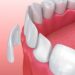 سرامیک های مورد استفاده در دندان سازی