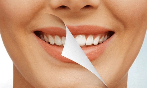 شما می توانید دندان های مصنوعی را با یک محلول پاک کننده تمیز کنید