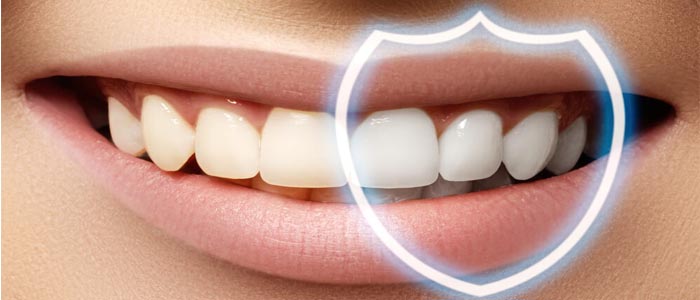 انواع کامپوزیت دندان و مزایای آن