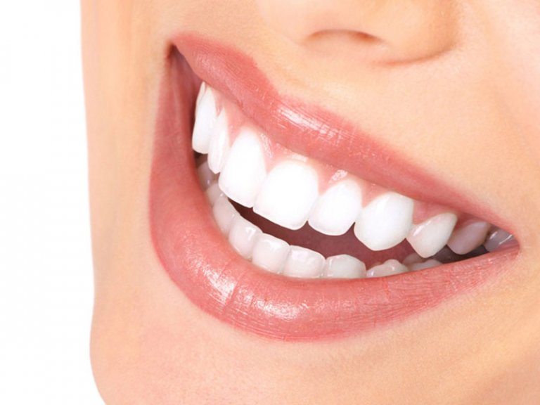 در چه مواردی می توان از لمینت برای اصلاح دندان ها استفاده کرد ؟