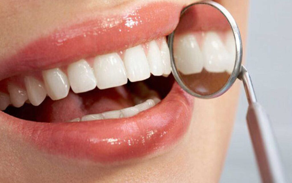 عوارض لمینت و کامپوزیت دندان