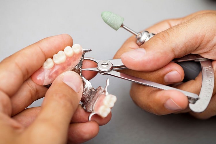 انواع دستگاه های پروتز دندان