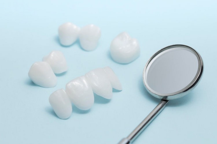 بهترین نوع ایمپلنت‌های دندانی کدام است؟