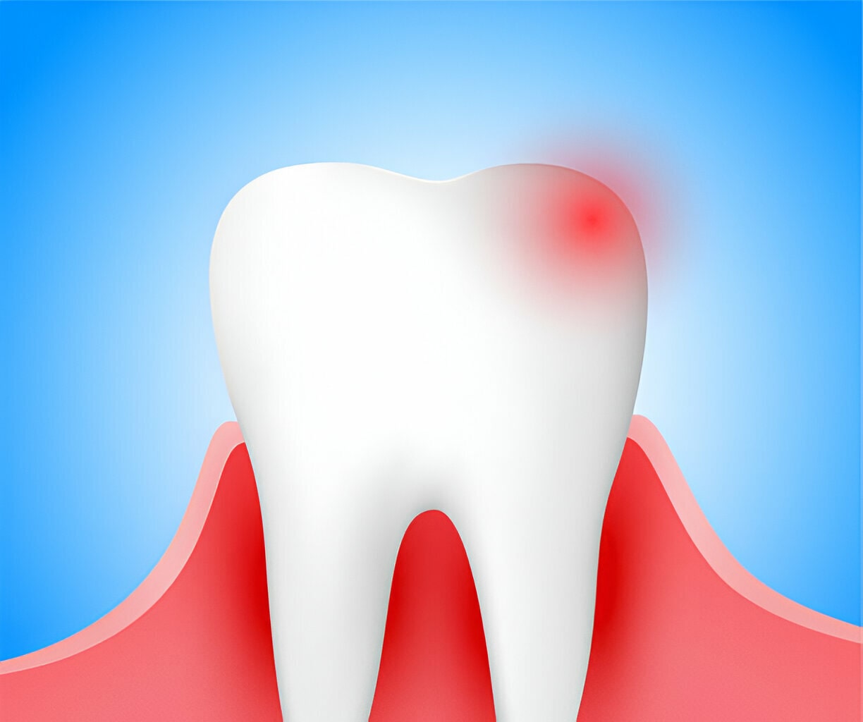 خرابی دندان و رفلاکس معده