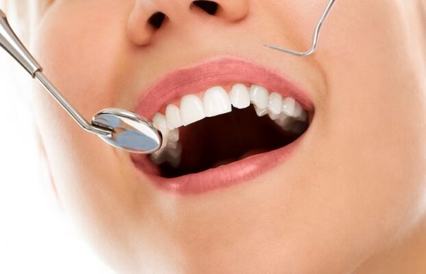 آبسه دندان چیست و انواع آن کدامند؟