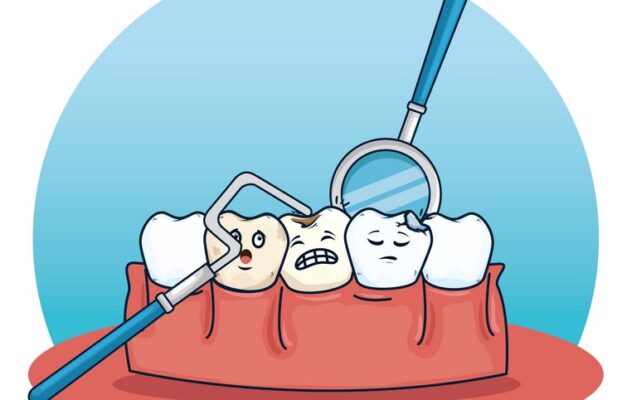 وارنیش فلوراید و نقش آن در جلوگیری از پوسیدگی دندان ها