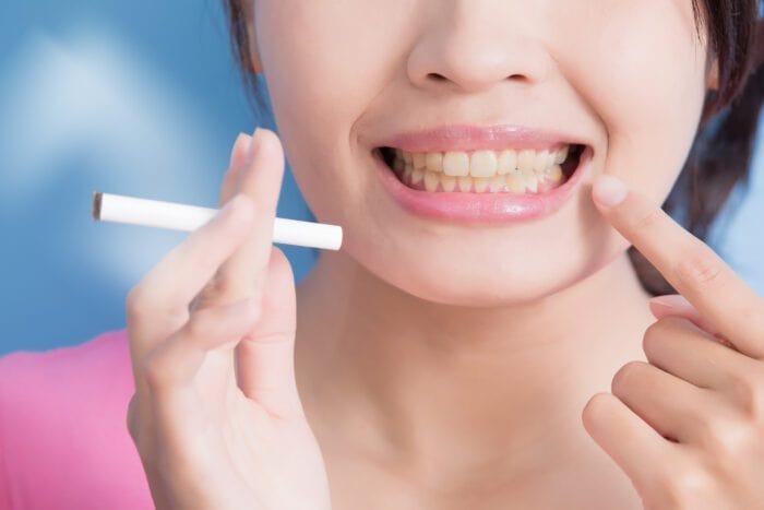 تاثیر سیگار بر ایمپلنت دندان و سلامت دهان