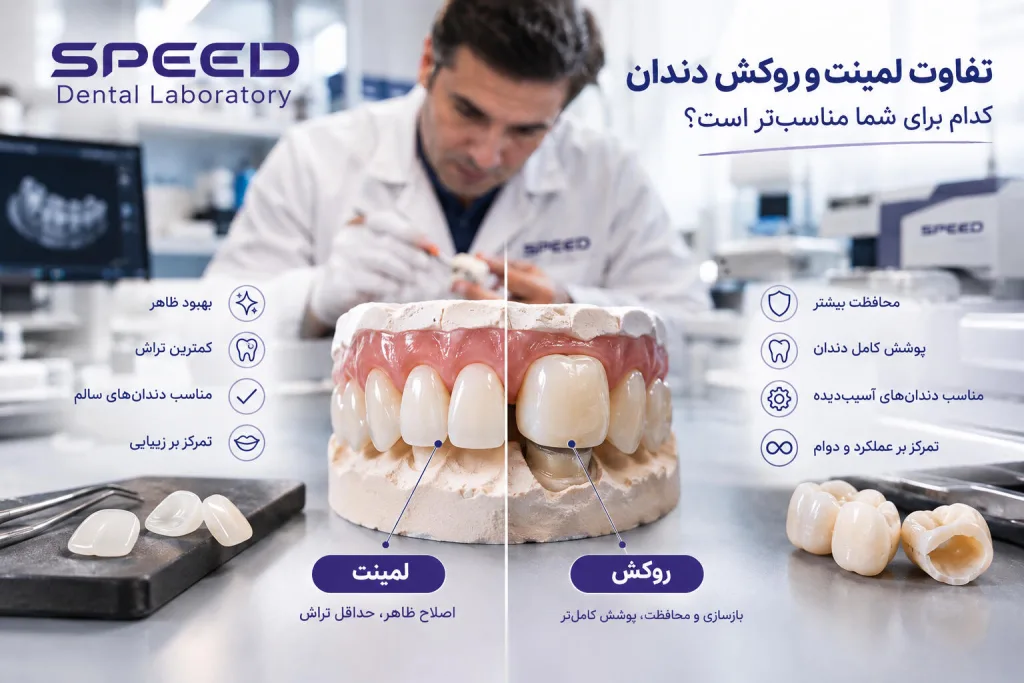 تفاوت لمینت و روکش دندان در لابراتوار اسپید