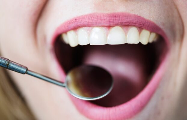 ویژگی و مزایای دندان‌های مصنوعی نشکن و انعطاف‌پذیر