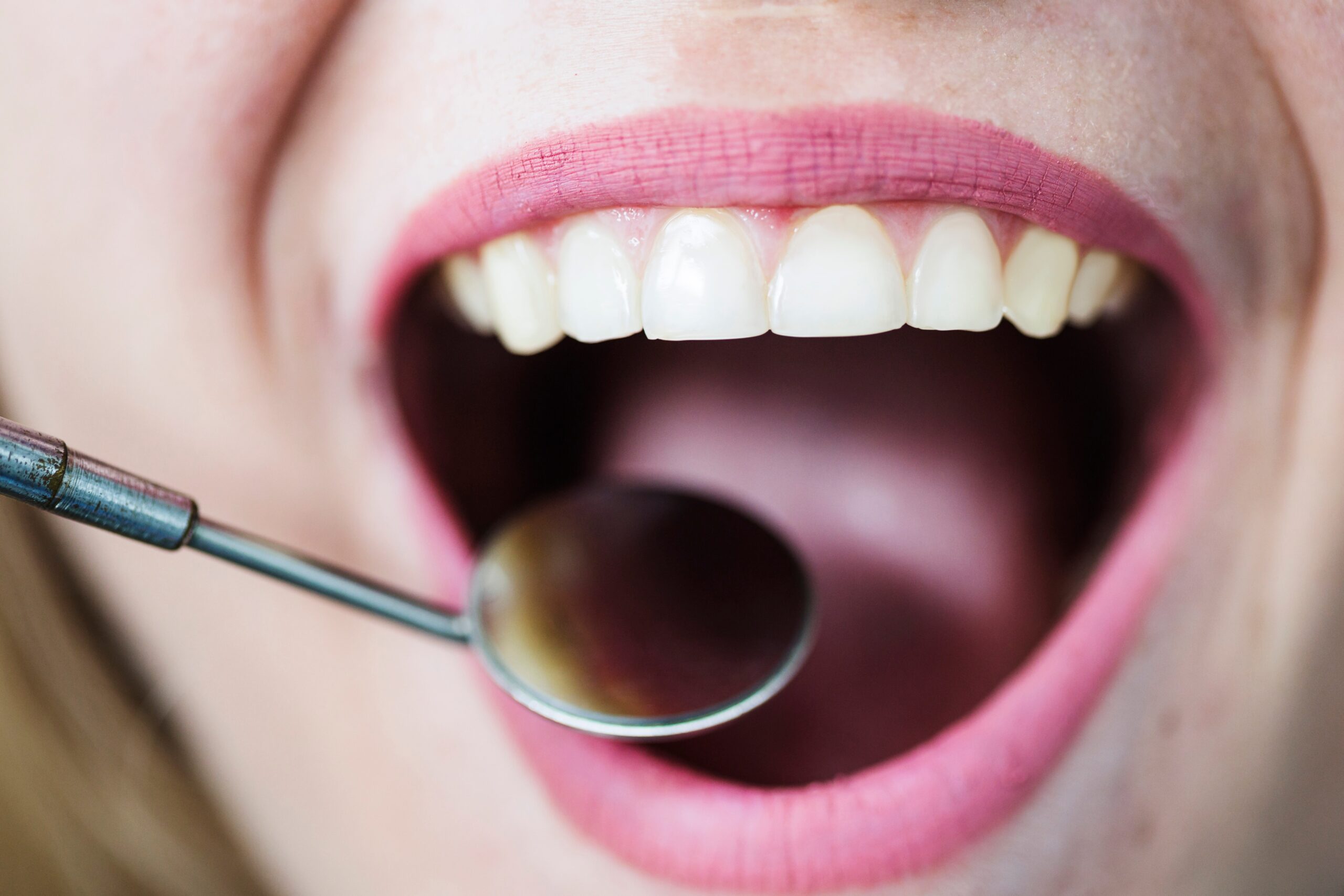 ویژگی و مزایای دندان‌های مصنوعی نشکن و انعطاف‌پذیر