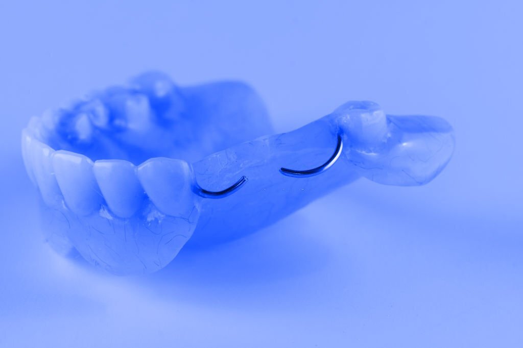 درمان پریودنتال با کشیدن دندان