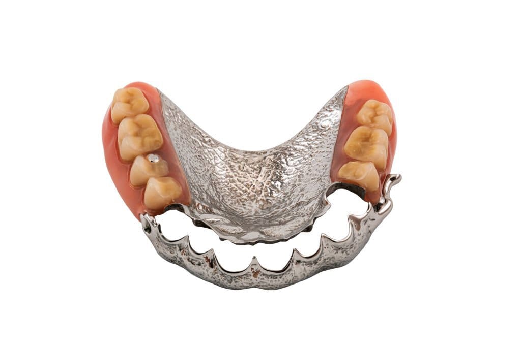 آیا کشیدن دندان بیماری پریودنتال را درمان می کند؟
