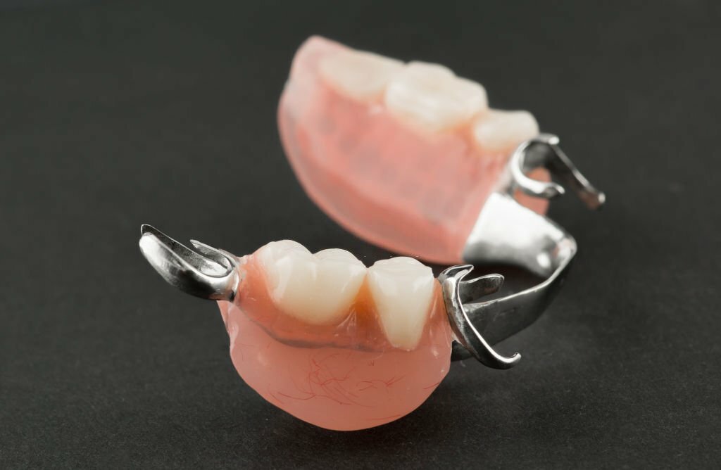 گزینه هایی برای جایگزینی موقت دندان