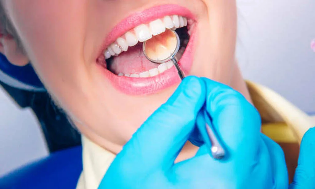 علل تحلیل لثه علل تحلیل لثه