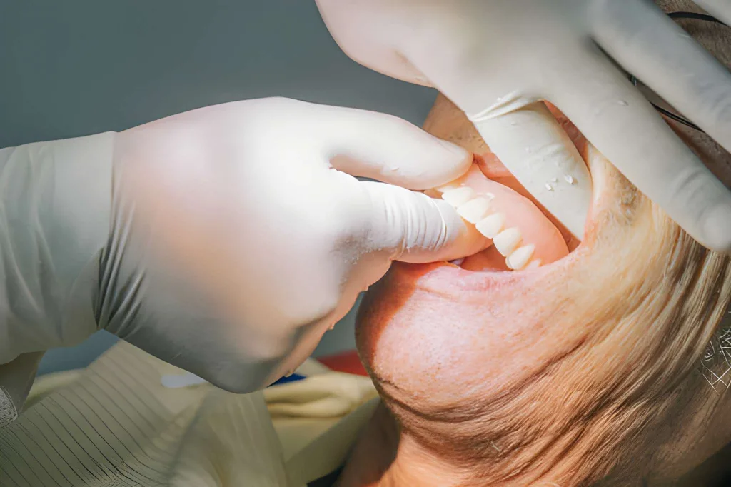 عادت کردن به دندان مصنوعی