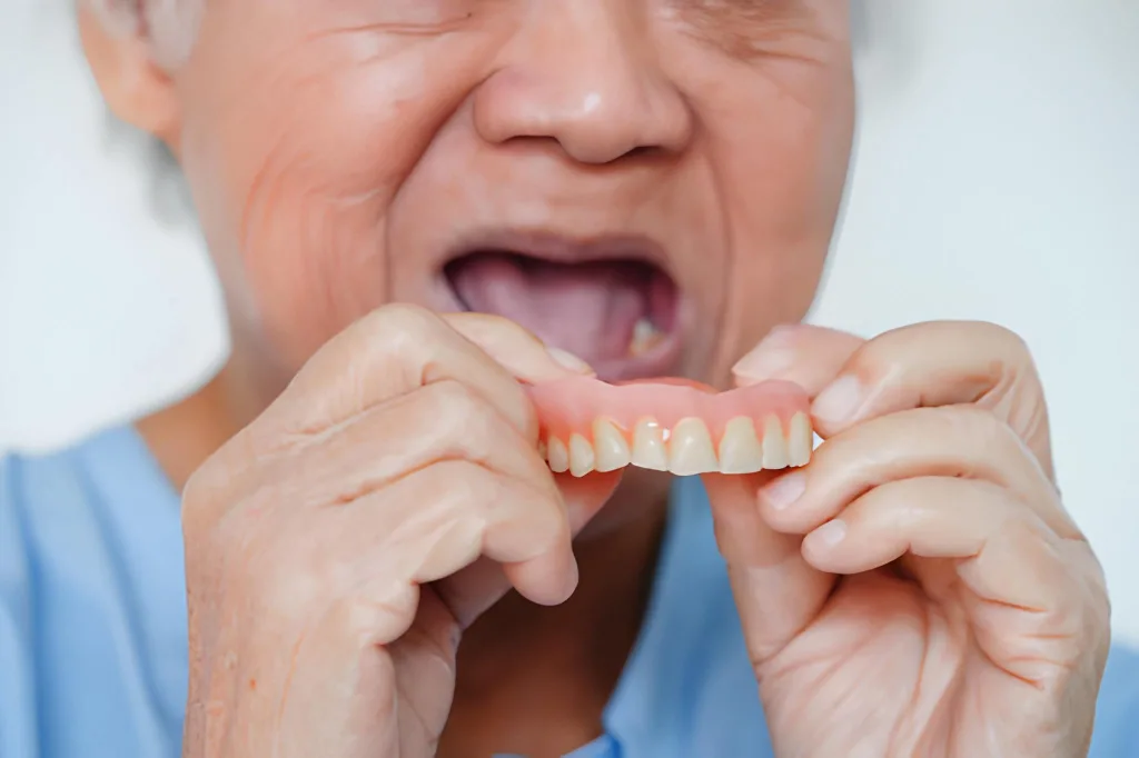 یابت و برفک دهانی زیر دندان مصنوعی