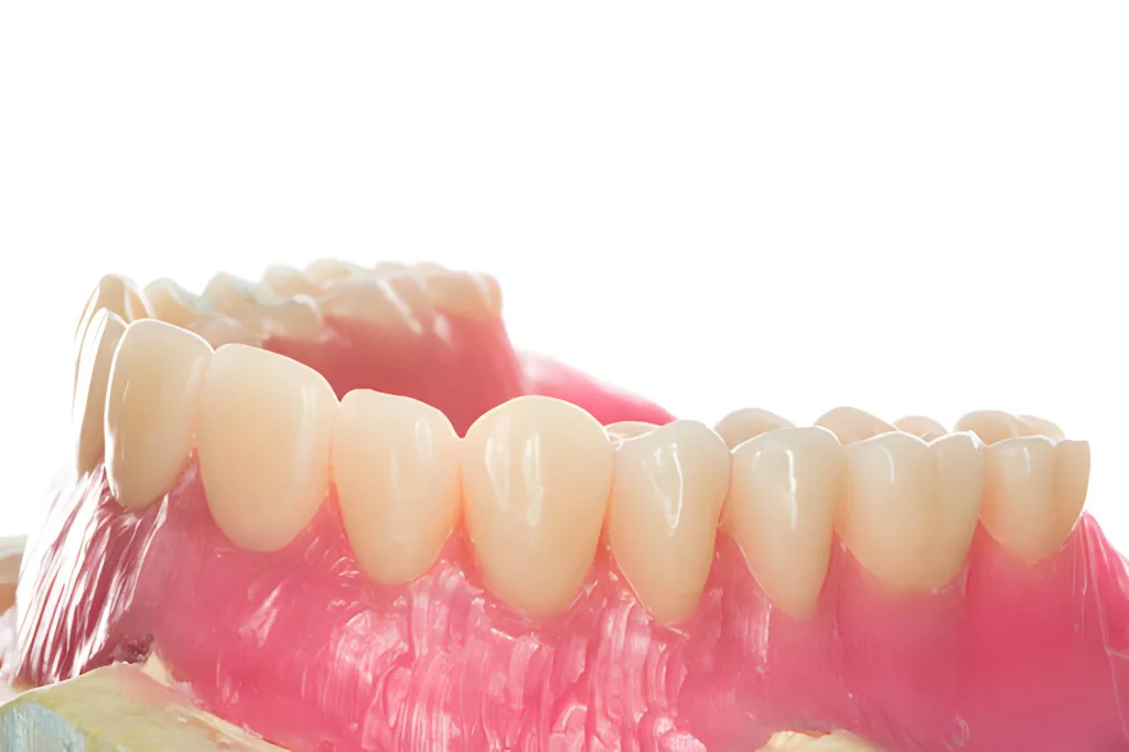 دندان مصنوعی سرامیکی چیست و آیا واقعاً بهترین انتخاب است؟