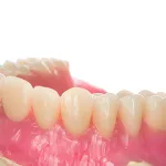 دندان مصنوعی سرامیکی چیست و آیا واقعاً بهترین انتخاب است؟