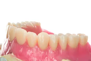 دندان مصنوعی سرامیکی چیست و آیا واقعاً بهترین انتخاب است؟