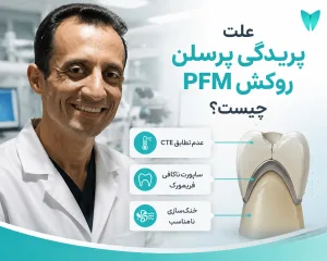 علت و راهکار پریدگی پرسلن روکش PFM