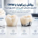 تفاوت زیرکونیا و PFM